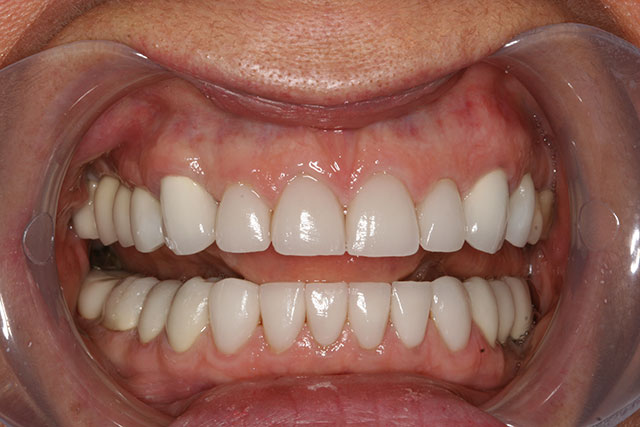 Port Chester dental images