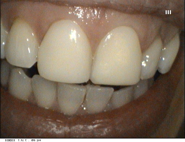 Port Chester dental images