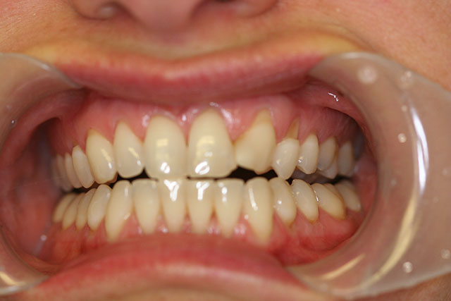 Harrison dental images