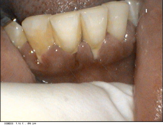 Harrison dental images