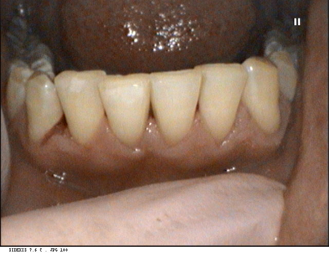 dental images 10528